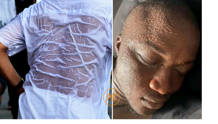 Public advised to stay hydrated as NiMet warns of nationwide sunny conditions 