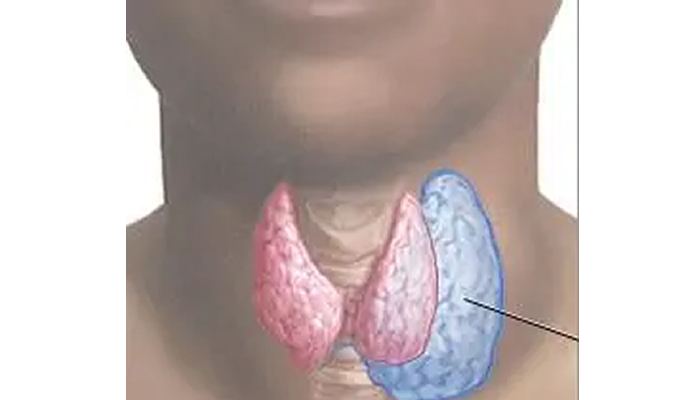 Silent crisis: 6m Nigerians have thyroid disease, say experts